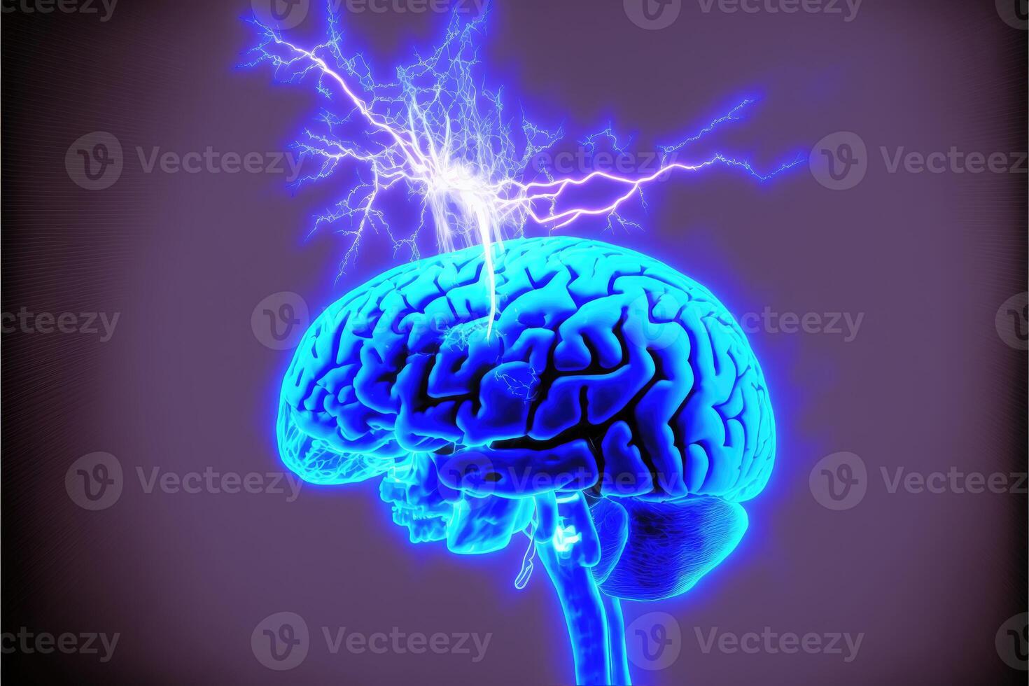 Brain injury abstract blue background. photo