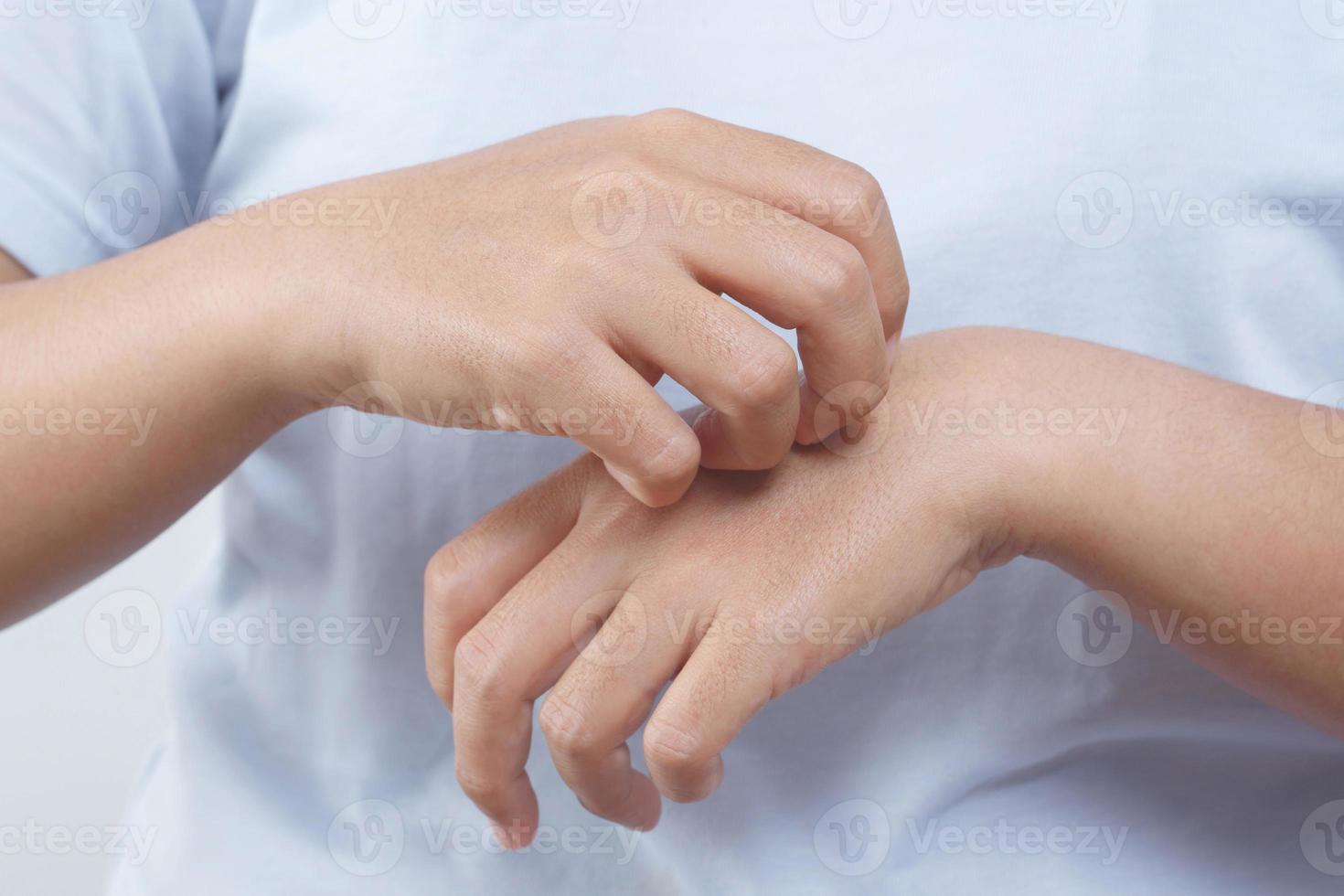 Health problems, woman has itchy hands photo