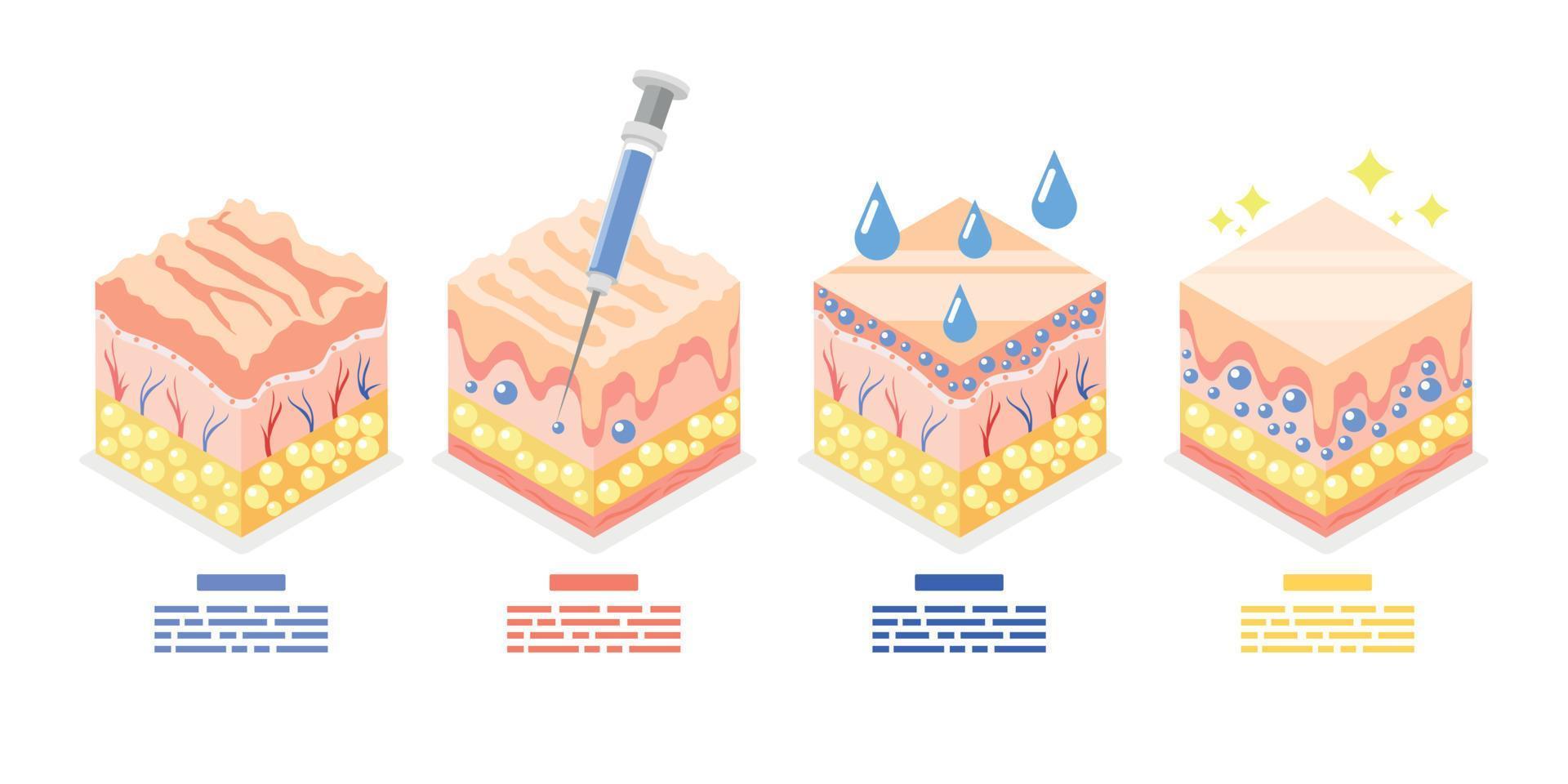 Skin Injections Isometric Set vector