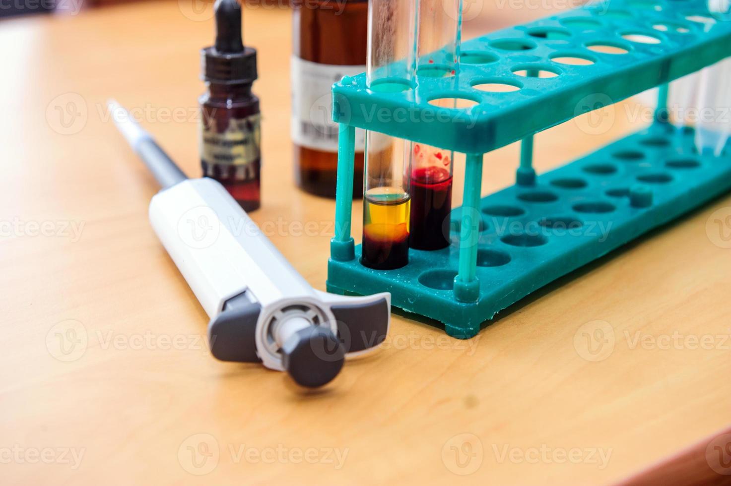 Hands with test tubes close-up. Hands in medical gloves hold tubes. Concept blood test for the presence of a virus. Viral disease test. Human blood in the laboratory. Virusology. photo