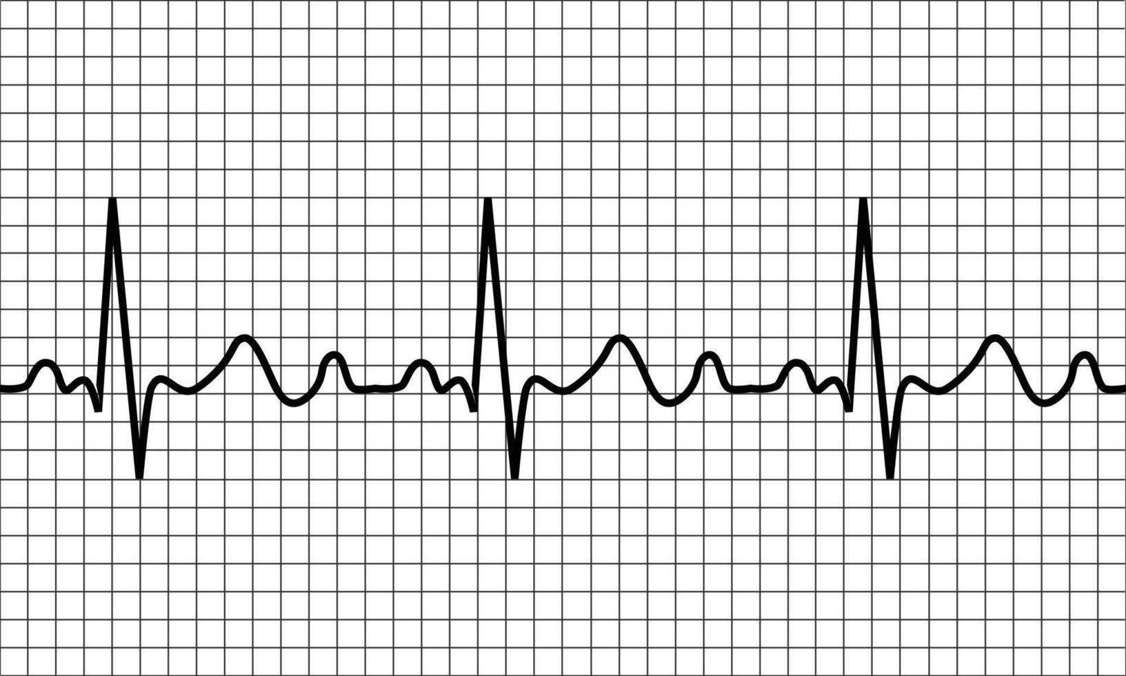 heartbeat icon. ECG Pathology Trace vector