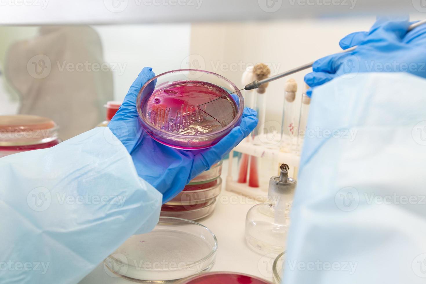 The hands of a physician laboratory assistant in an infectious disease laboratory examines the samples. photo