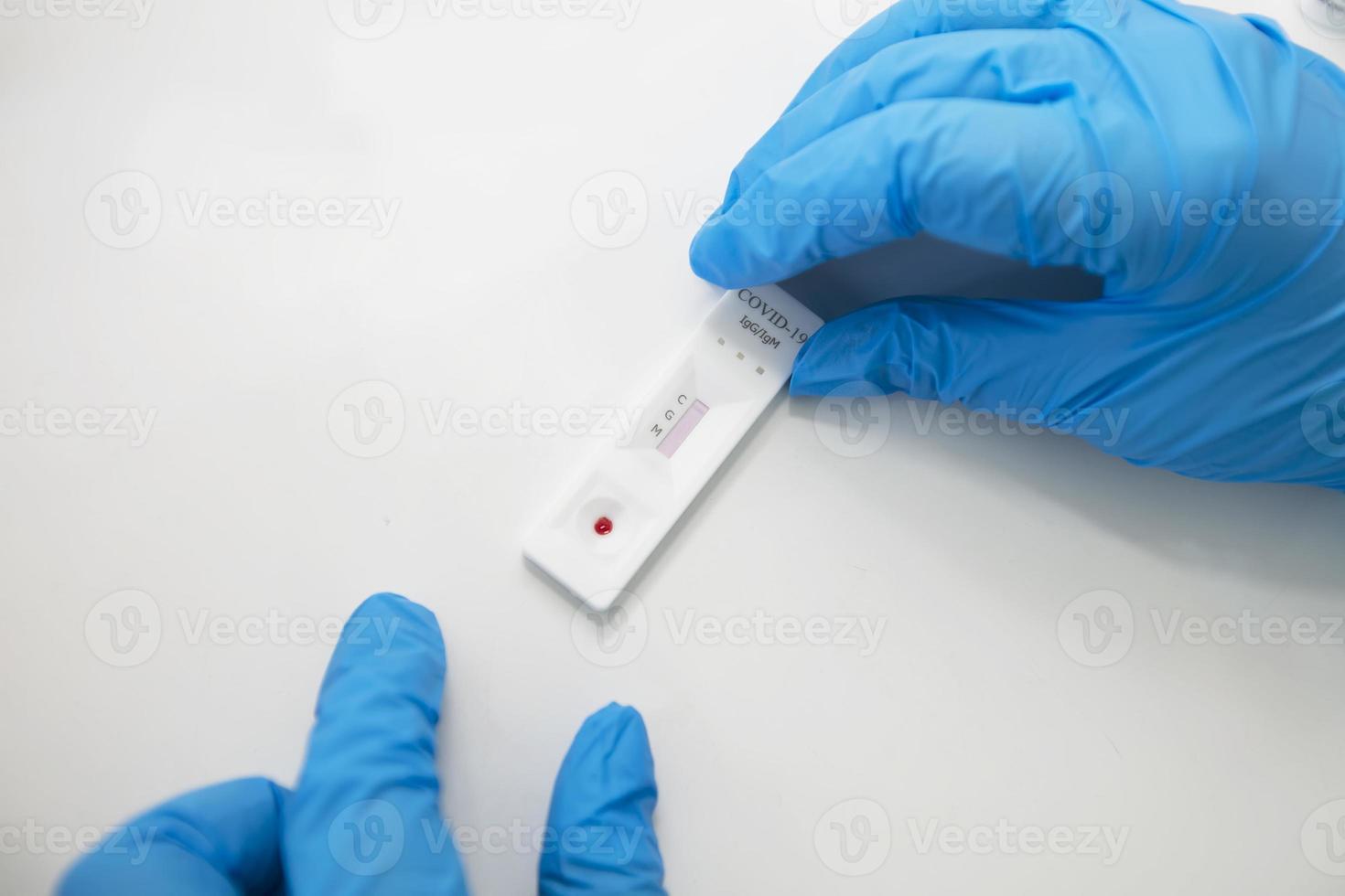 Hands of a COVID-19 negative doctor with a COVID-19 2019-nCoV viral disease testing kit. A quick test for COVID-19. photo