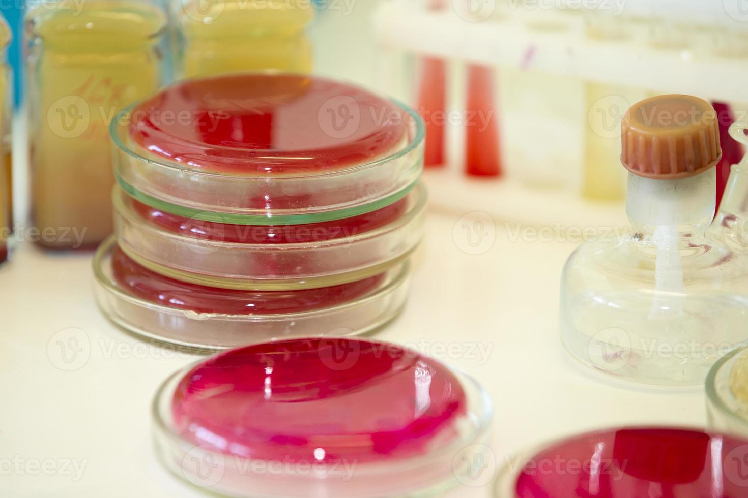Bacterial colonies of streptococci with alpha hemolytics on a blood agar plate. Infection laboratory at the hospital. photo