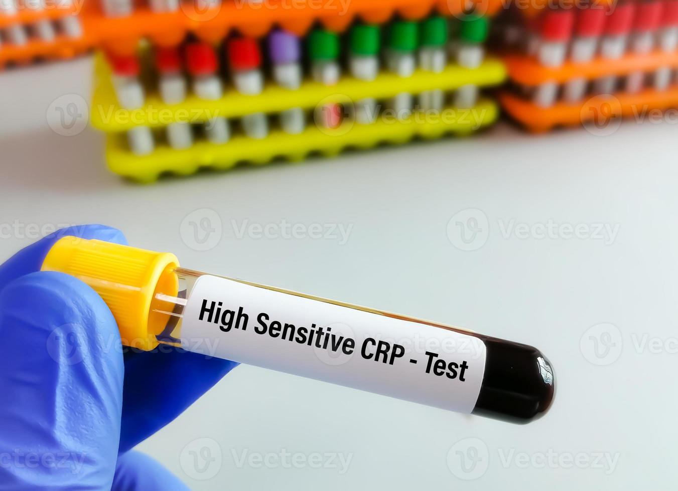 Blood sample tube for hsCRP or high sensitive CRP test, for the