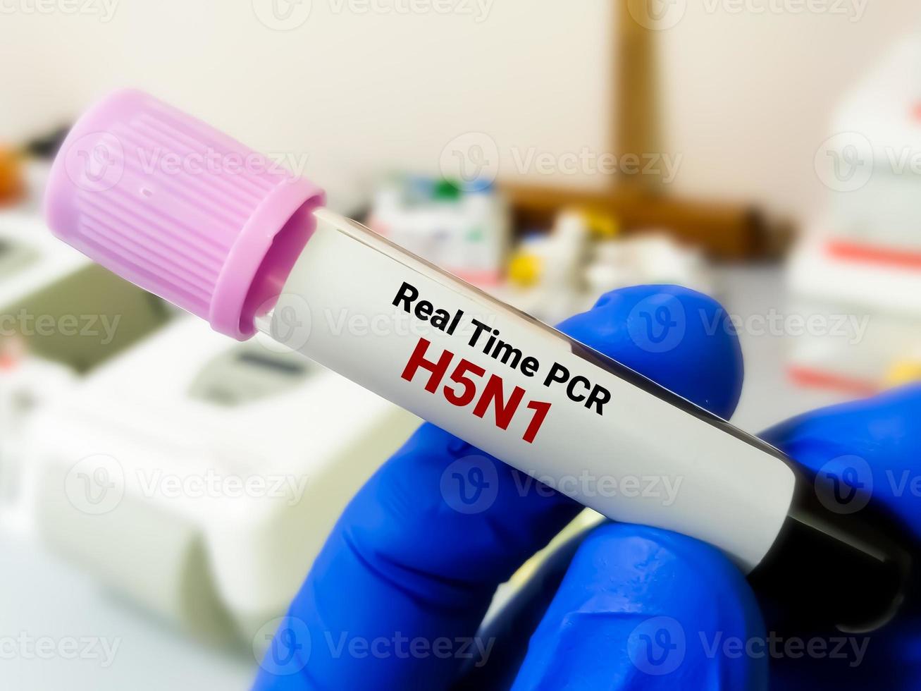H5N1 influenza virus Screening positive blood sample for PCR testing for the confirmation of infection. photo