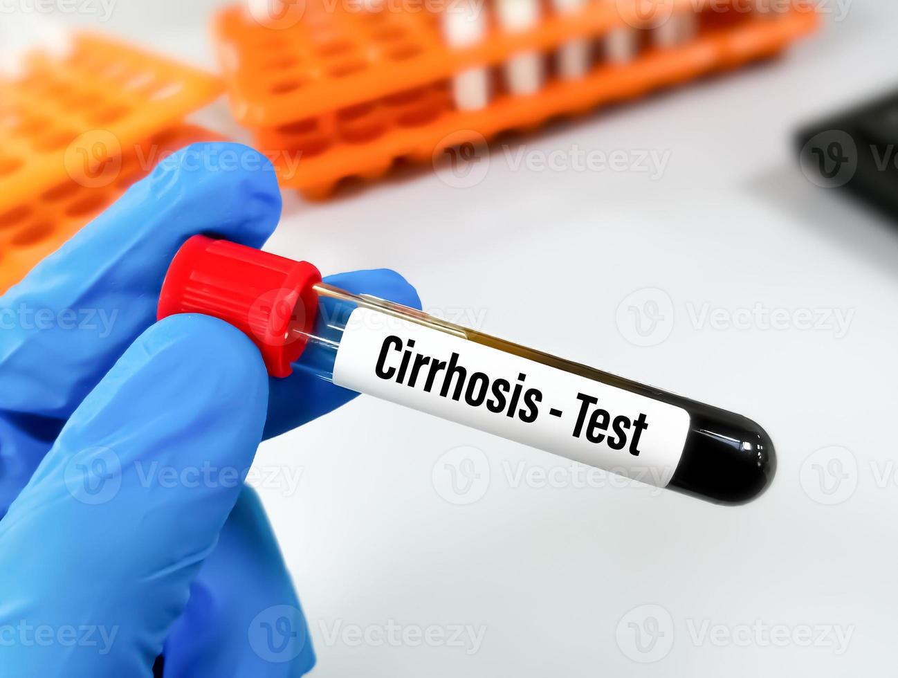 Medical laboratory scientist holding a test tube with blood for