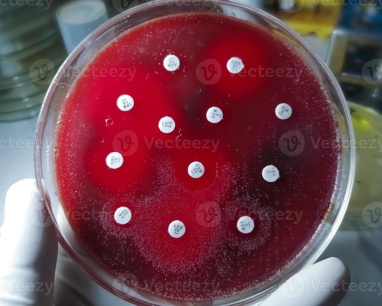 Antimicrobial susceptibility testing in petri dish. Antibiotic resistance of bacteria photo