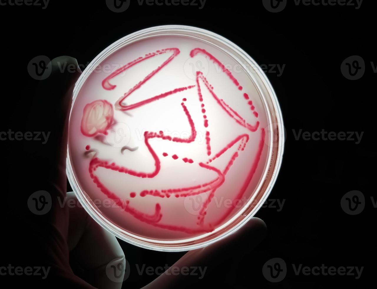 colonia de bacterias en placa de medios de cultivo, cultivo de heces foto