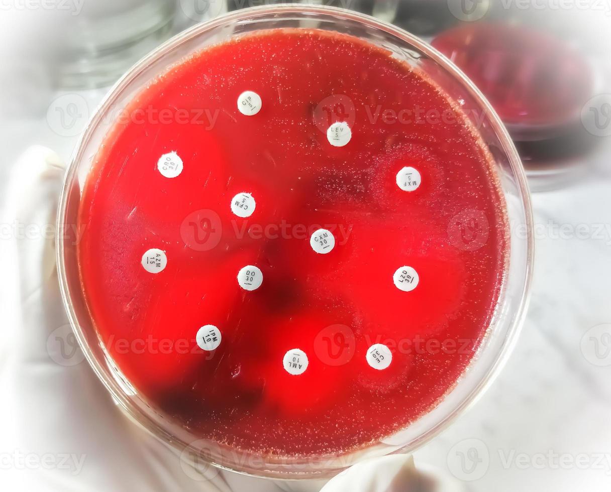 Antimicrobial susceptibility testing in petri dish. Antibiotic resistance of bacteria photo