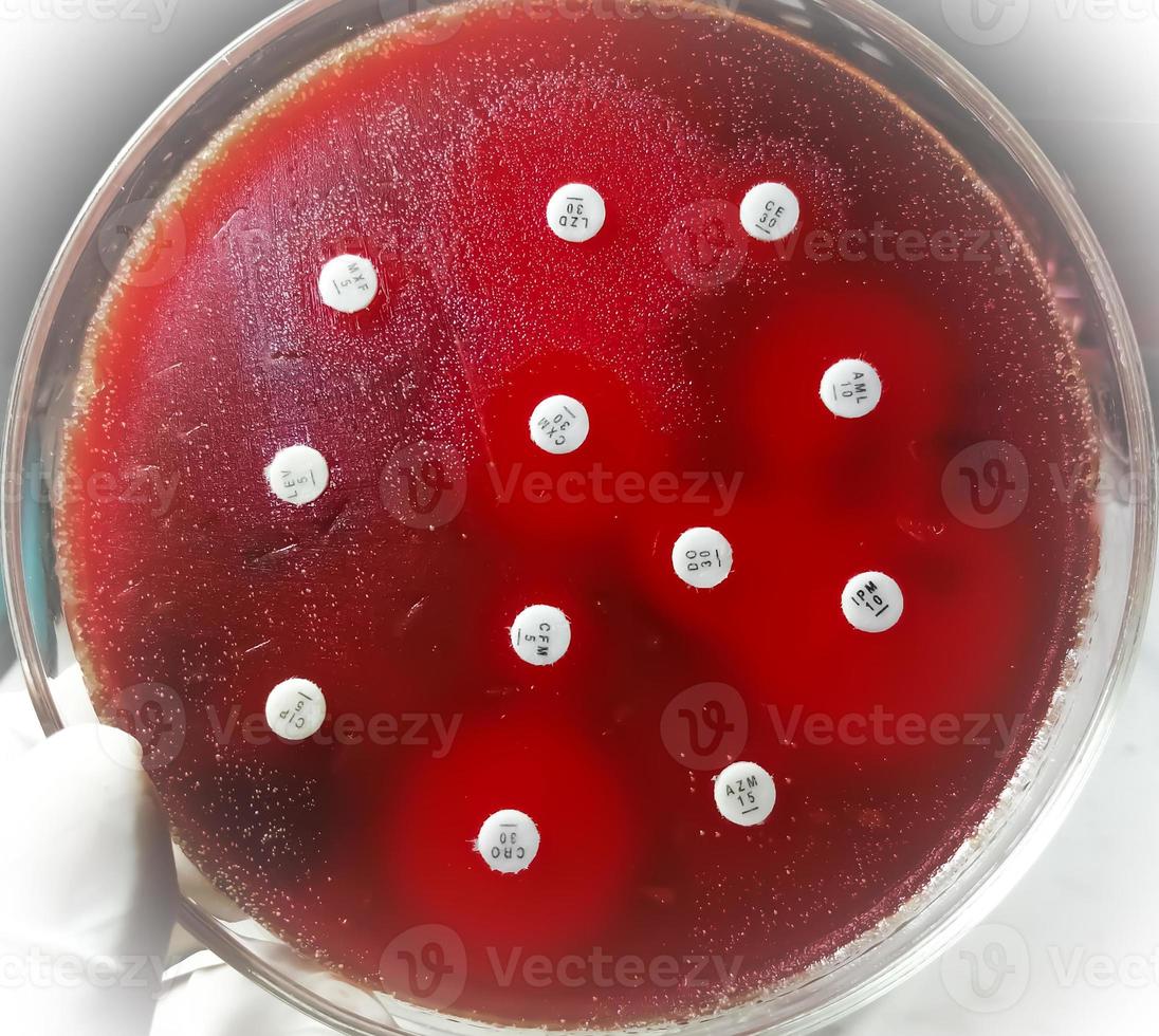 Antimicrobial susceptibility testing in petri dish. Antibiotic resistance of bacteria photo