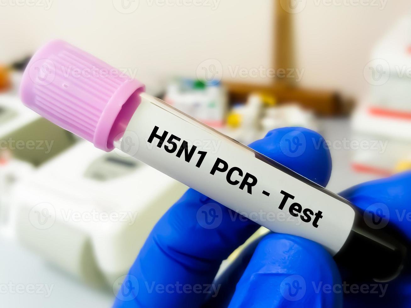 H5N1 influenza virus Screening positive blood sample for PCR testing for the confirmation of infection. photo
