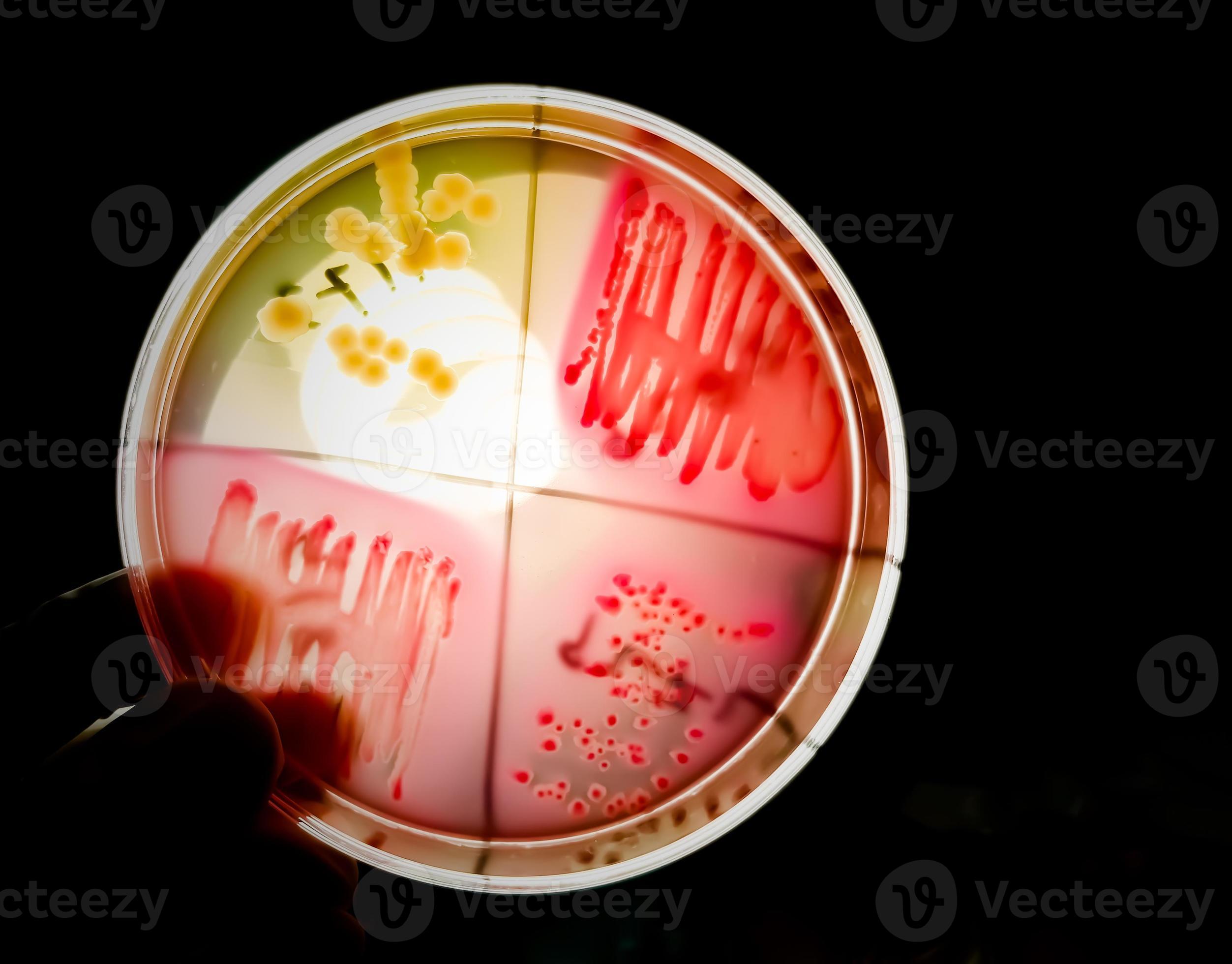 Bacteria colony on culture media plate. Bacterial culture testing