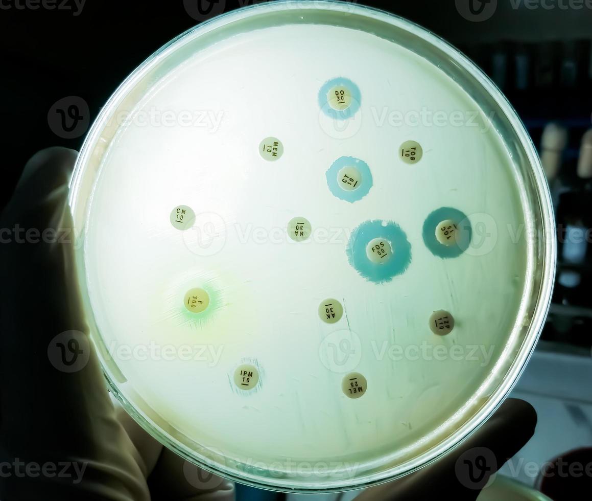 Antimicrobial susceptibility testing in petri dish. Antibiotic resistance of bacteria photo