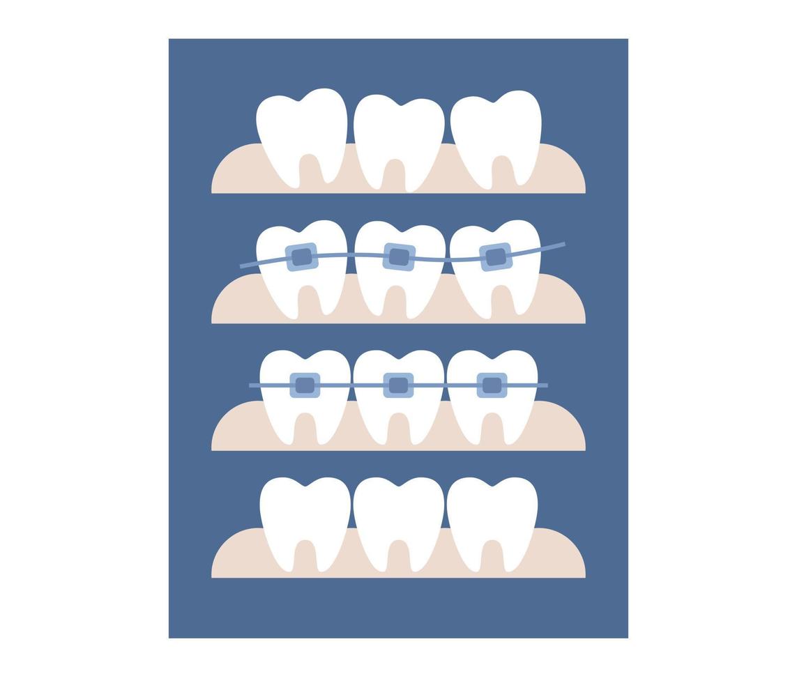 Dental braces icon. Orthodontic treatment and cosmetic odontology. Before after straightening teeth. Vector flat illustration