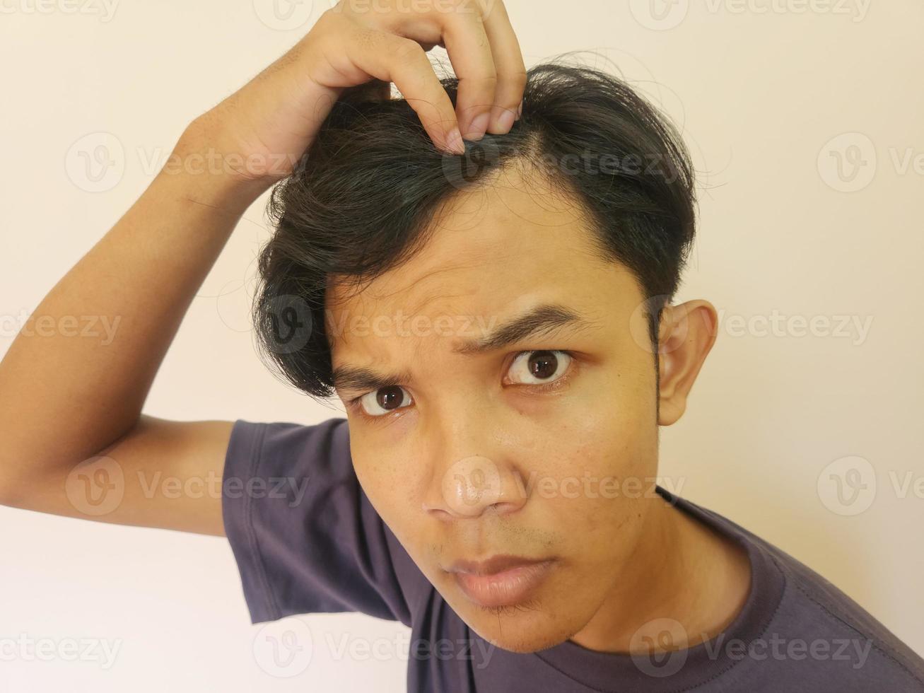 Shocked face of Asian man getting bald and lost hair in isolated white background photo