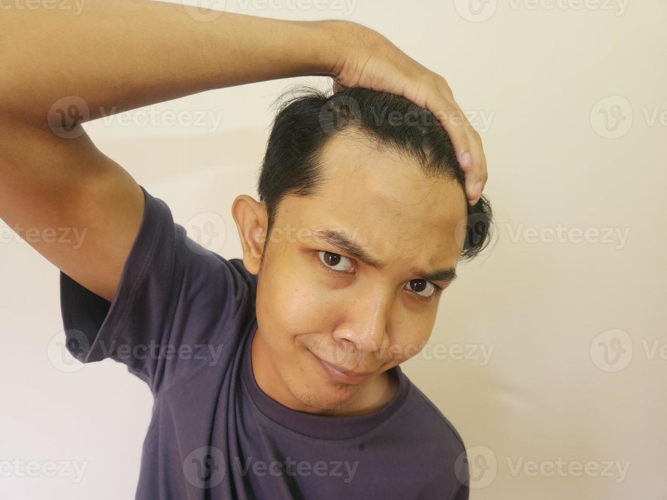 Shocked face of Asian man getting bald and lost hair in isolated white background photo