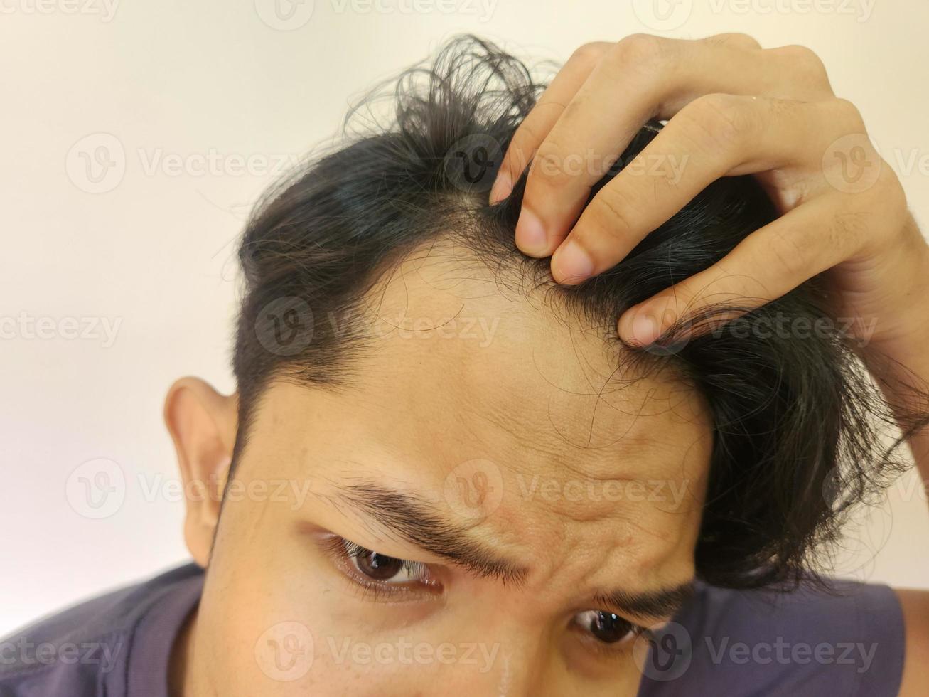 Shocked face of Asian man getting bald and lost hair in isolated white background photo