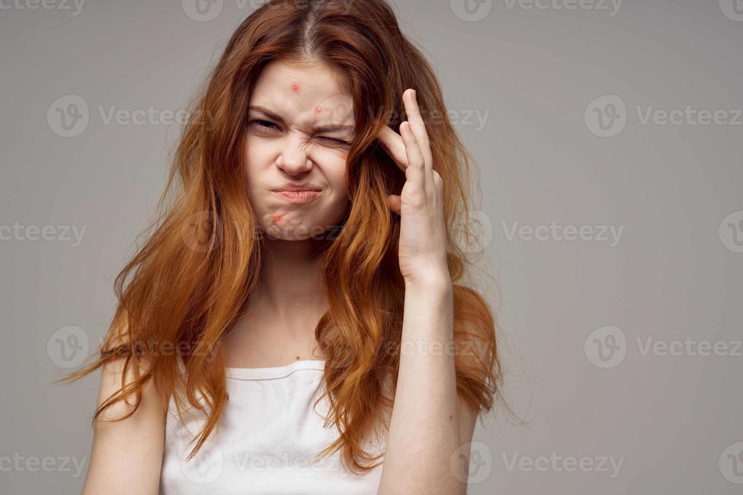 beautiful woman in a white t-shirt pimples on the face isolated background photo