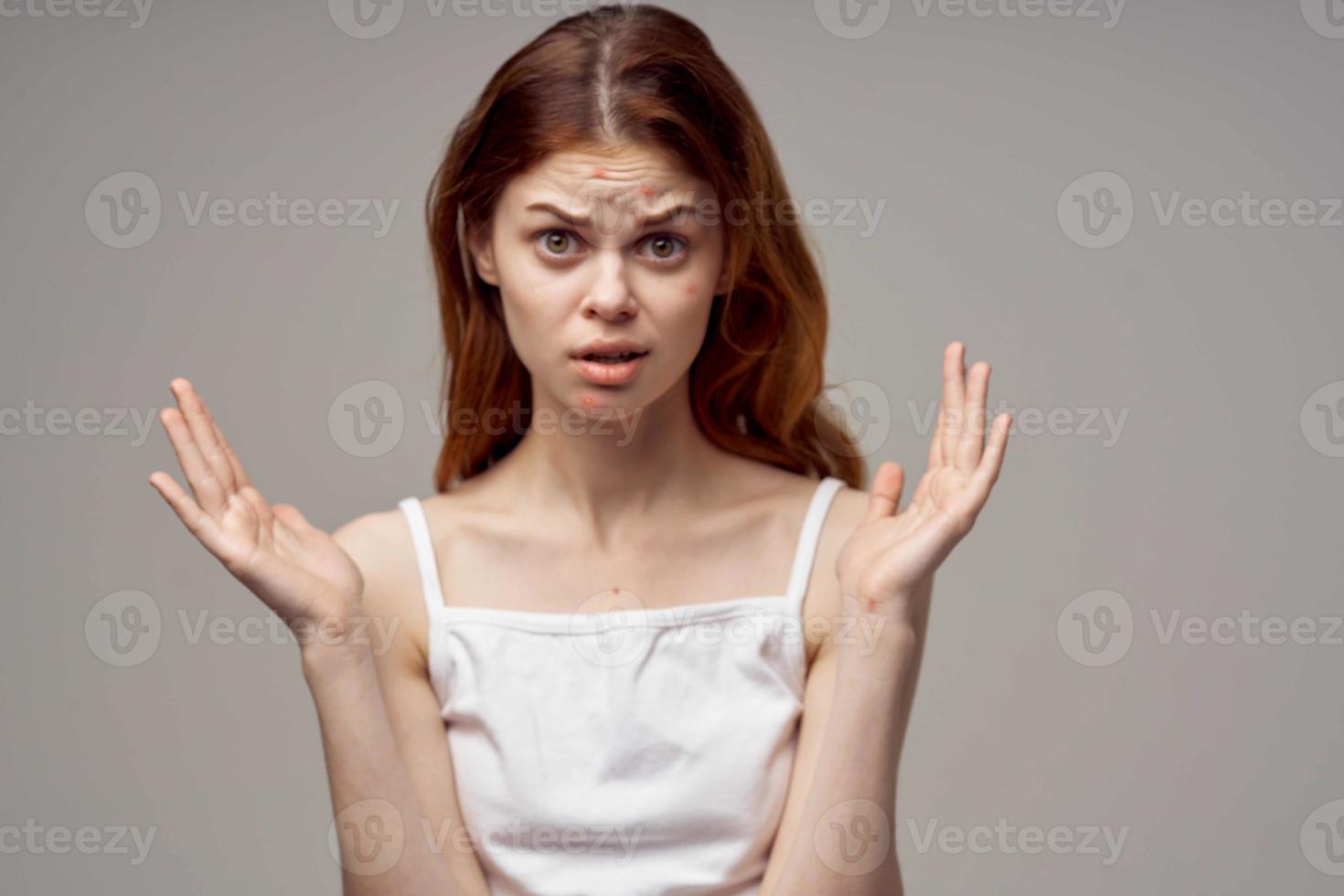 red-haired woman in a white t-shirt pimples on the face close-up photo