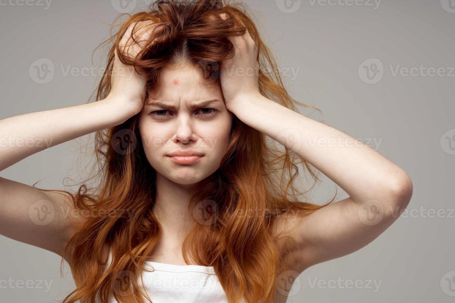red-haired woman in a white t-shirt pimples on the face light background photo