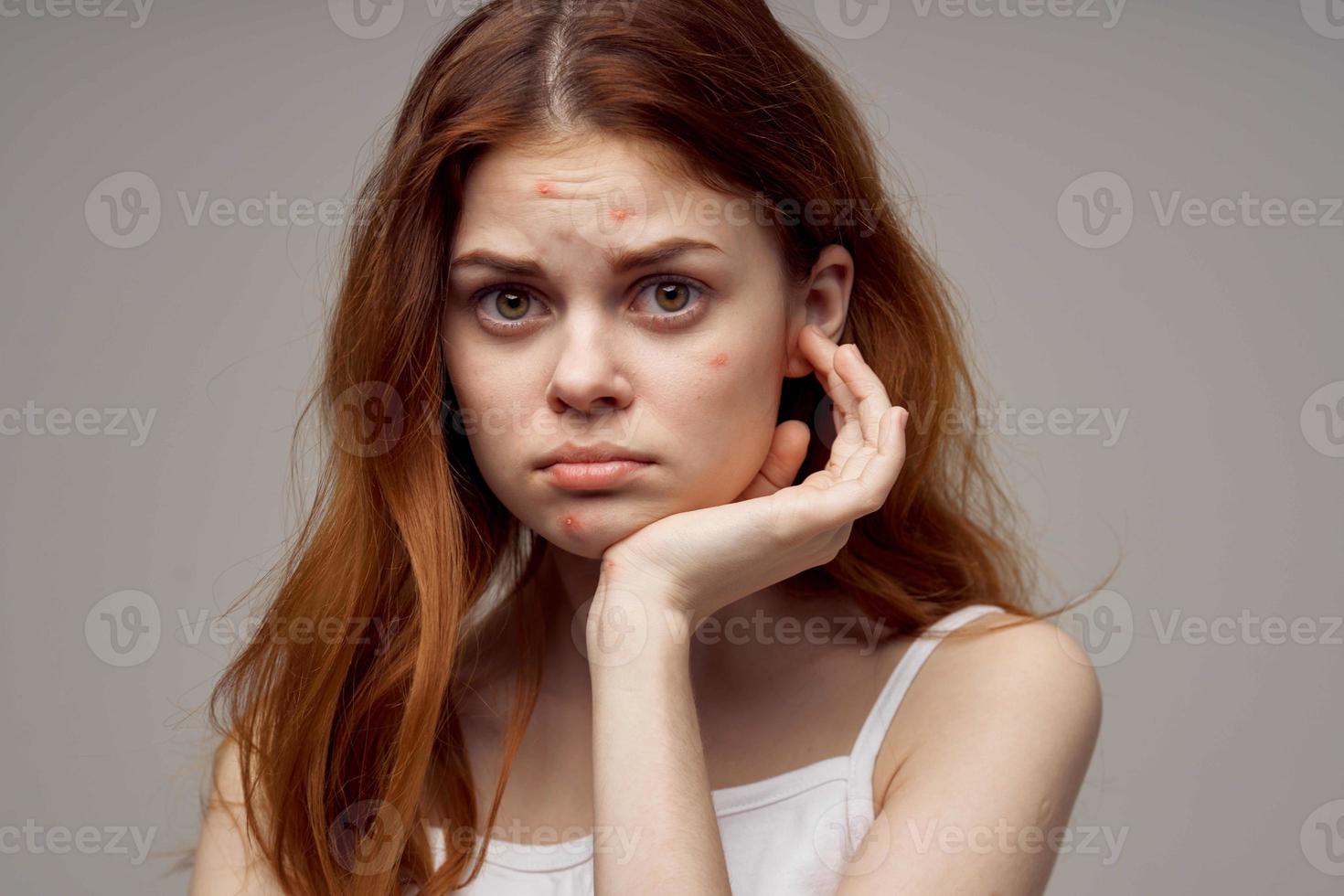 bonito mujer en un blanco camiseta espinillas en el cara ligero antecedentes foto