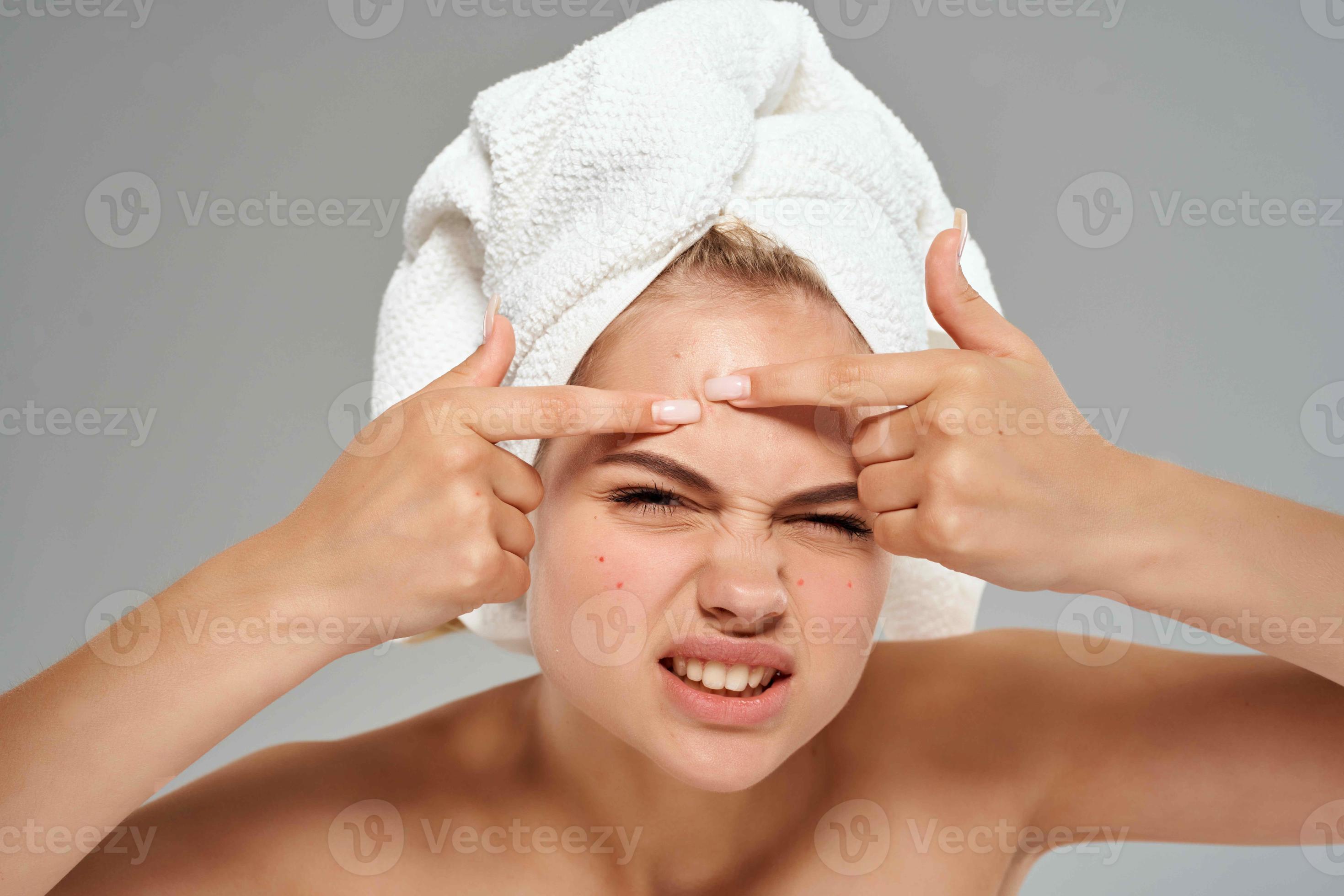 woman with bare shoulders squeeze pimples on her face towel on her head