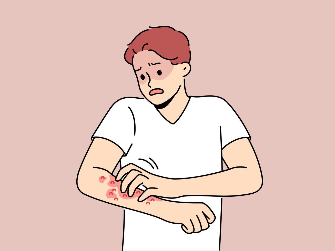 insalubre hombre rasguño rojo espinillas en brazo sufrir desde alergia o dermatitis. estresado indispuesto chico sufrir desde picazón y enrojecimiento. cuidado de la salud. vector ilustración.