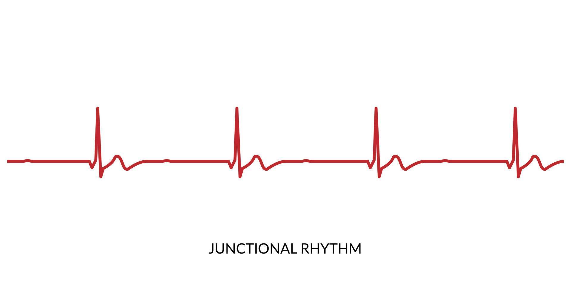ECG Heartbeat Line. Electrocardiogram vector illustration. Junctional Rhythm