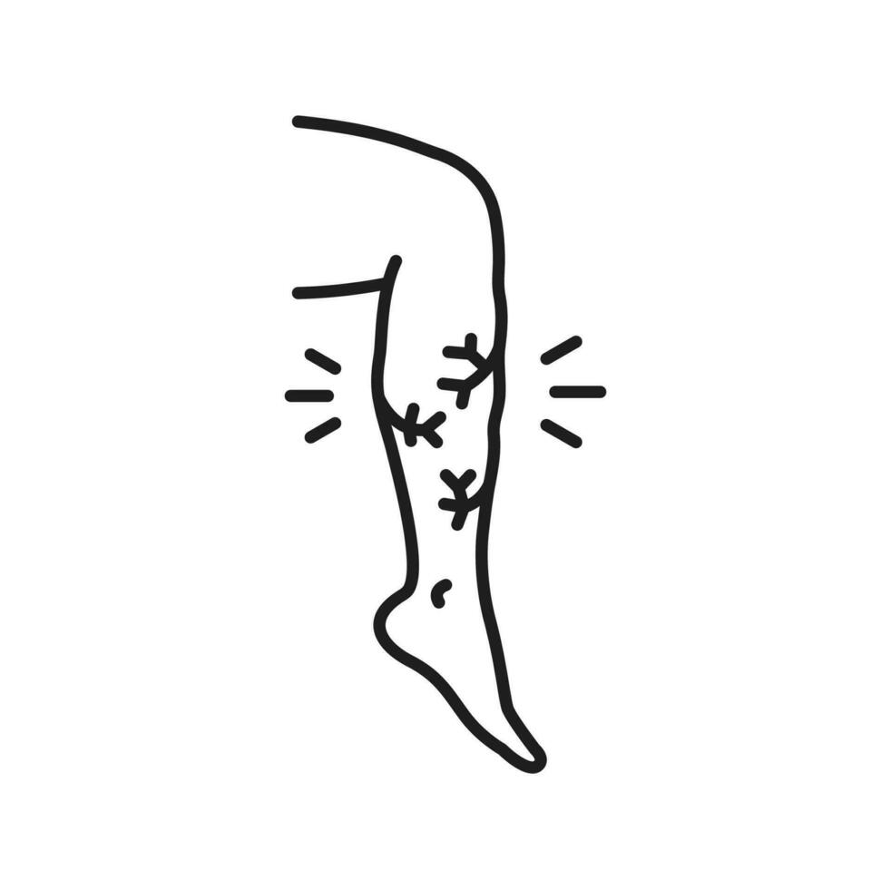 Varicose vein, venous edema on leg line icon vector