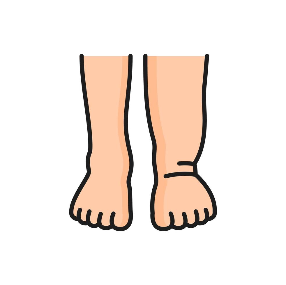 Lymphedema, swelling legs and edema color icon vector