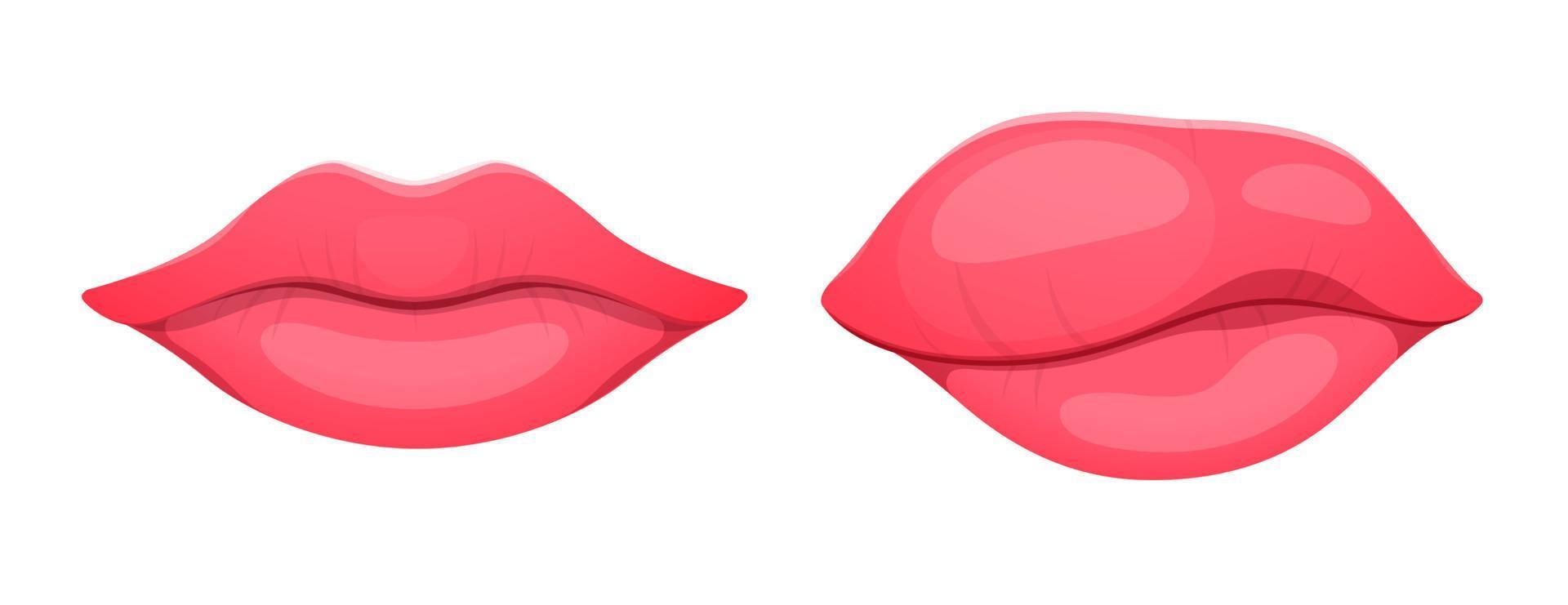 Angioedema or edema disease woman swelling lips vector