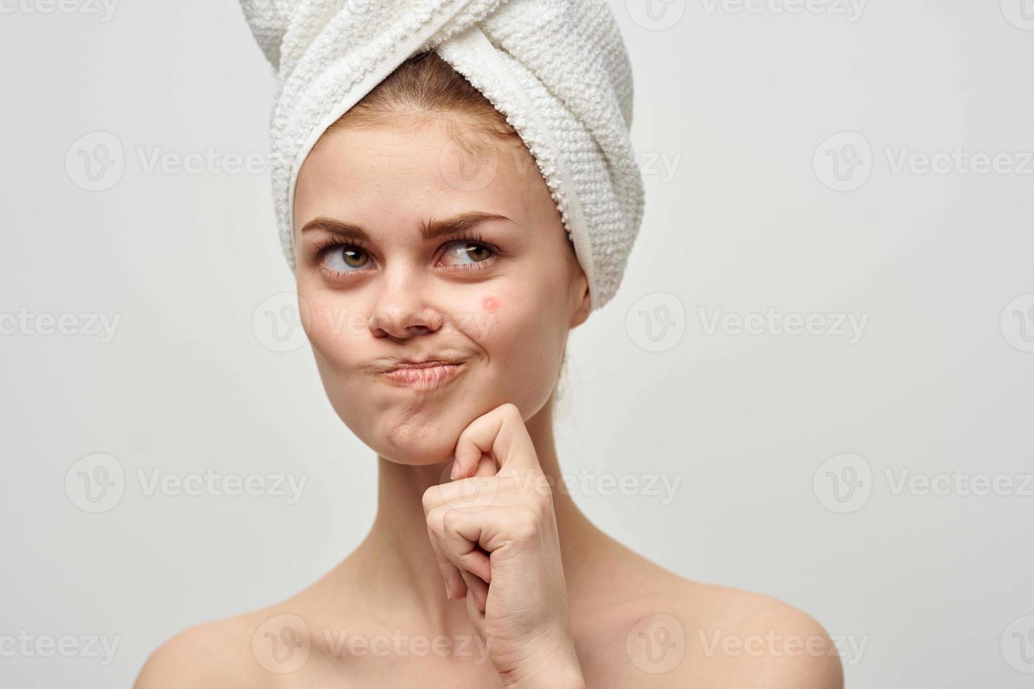 woman with a pimple on the face skin problems close-up photo