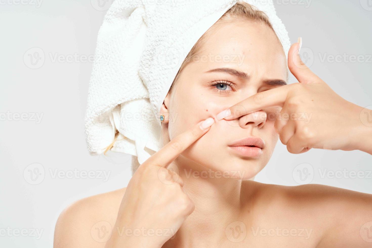 woman with bare shoulders with a towel on her head acne dermatology photo