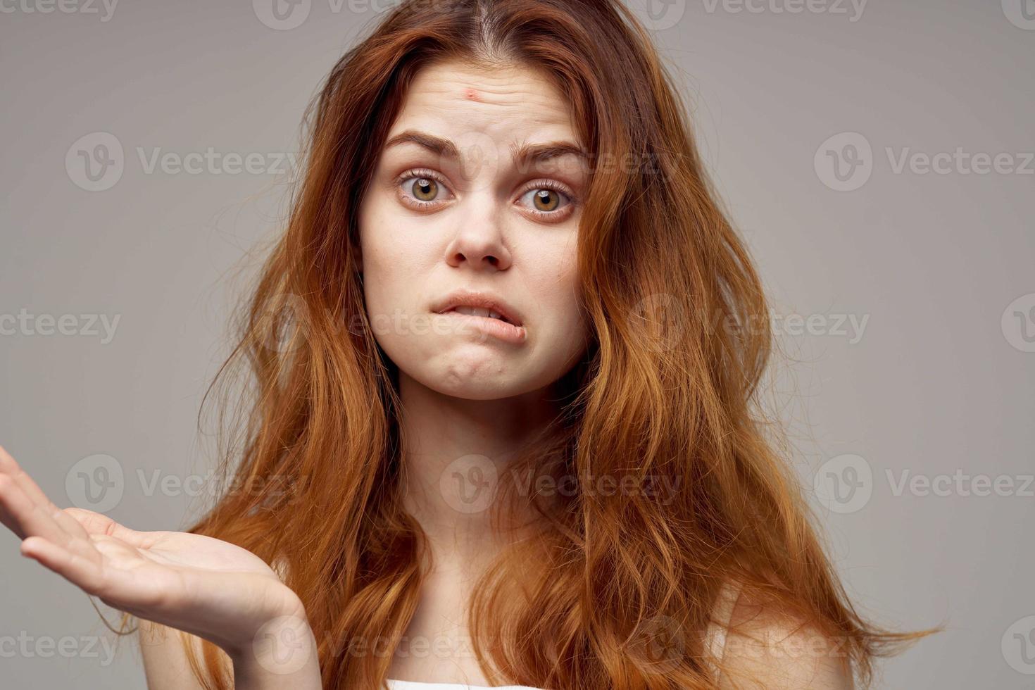 beautiful woman in a white t-shirt pimples on the face close-up photo