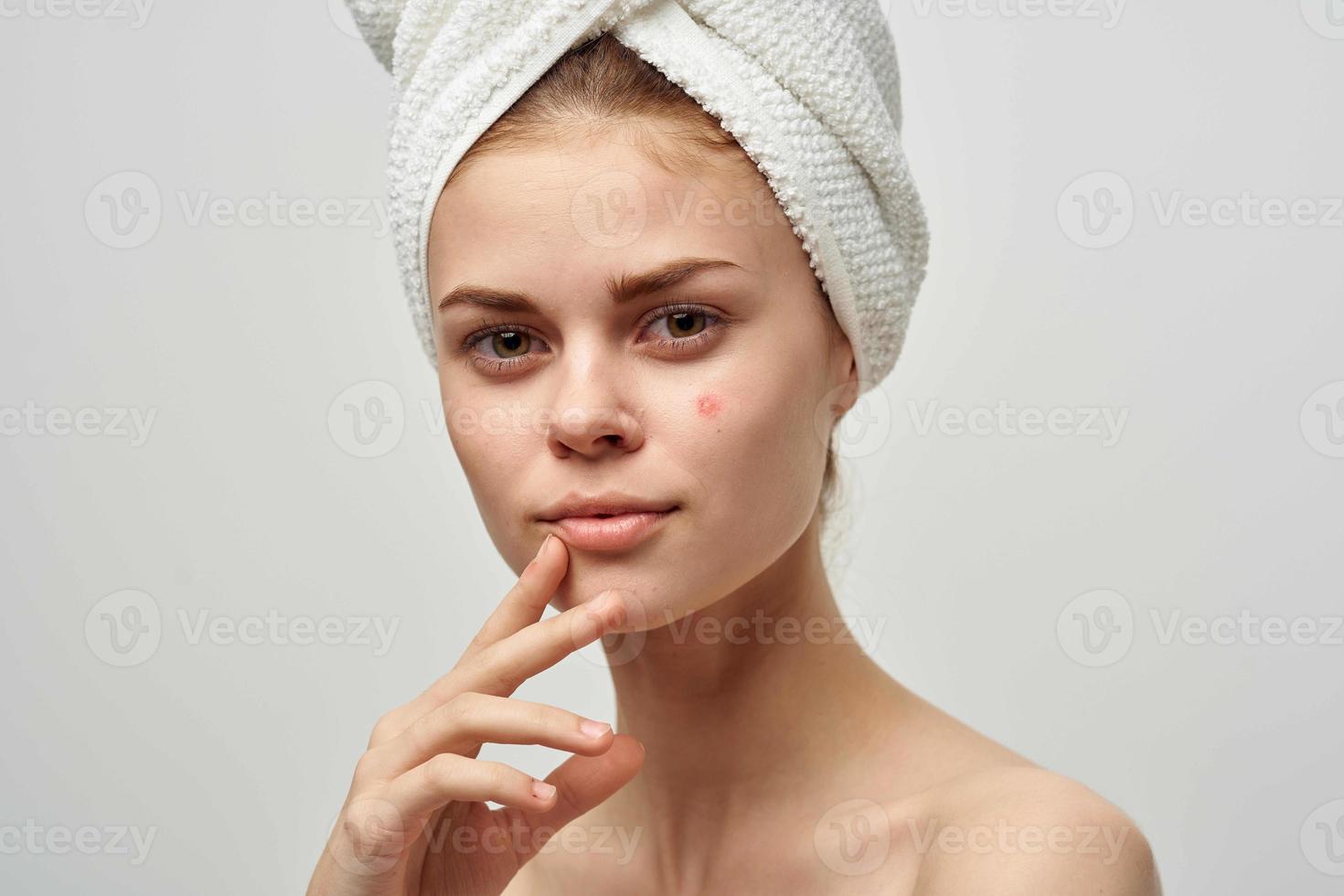 woman with a pimple on the face skin problems close-up photo