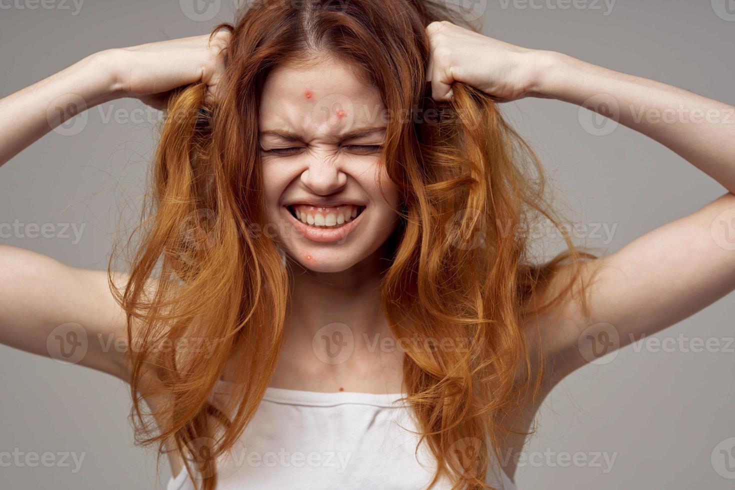 pretty woman in a white t-shirt pimples on the face light background photo