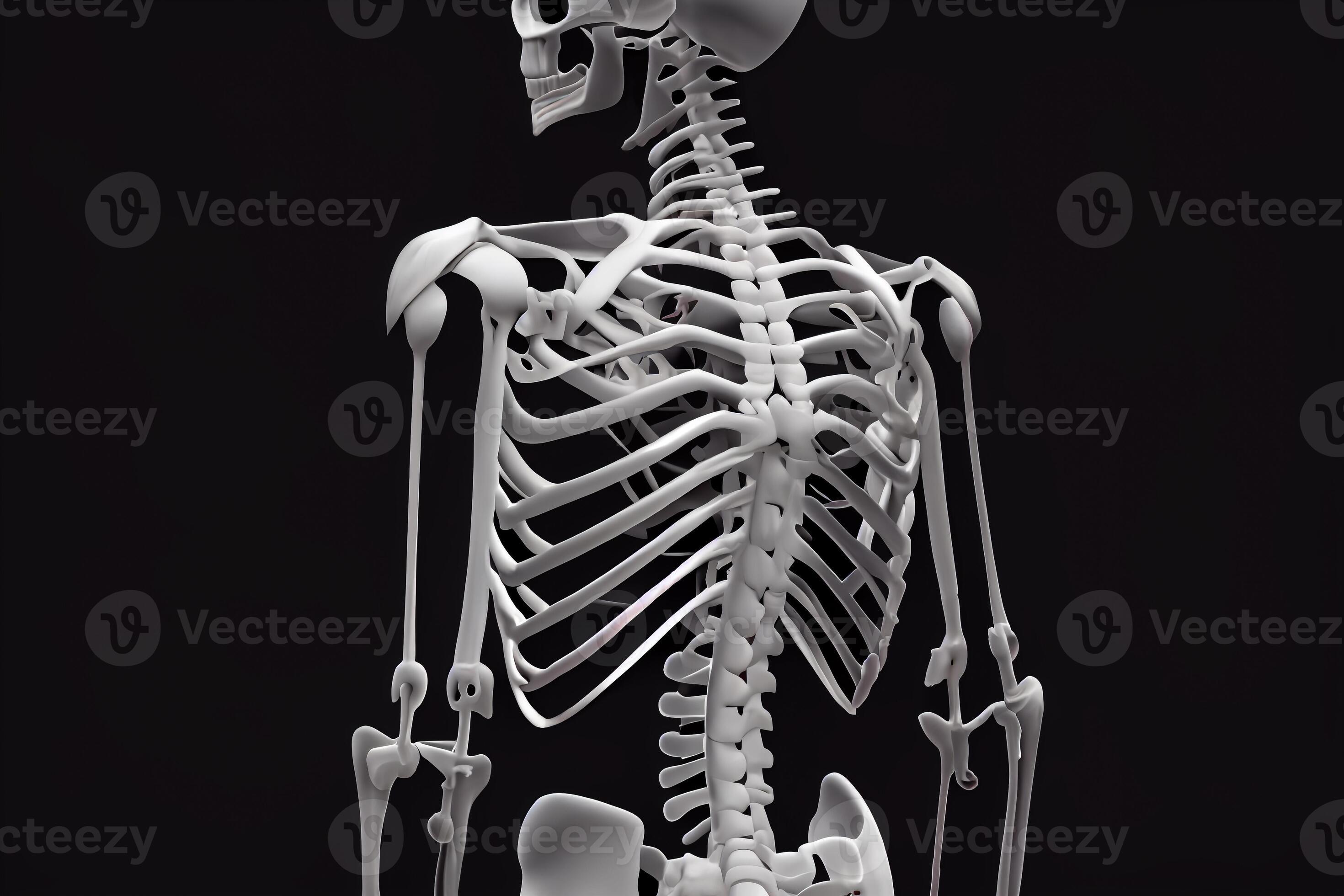 curved spine scoliosis, human skeleton with scoliosis, illustration 22080897 Stock Photo at Vecteezy