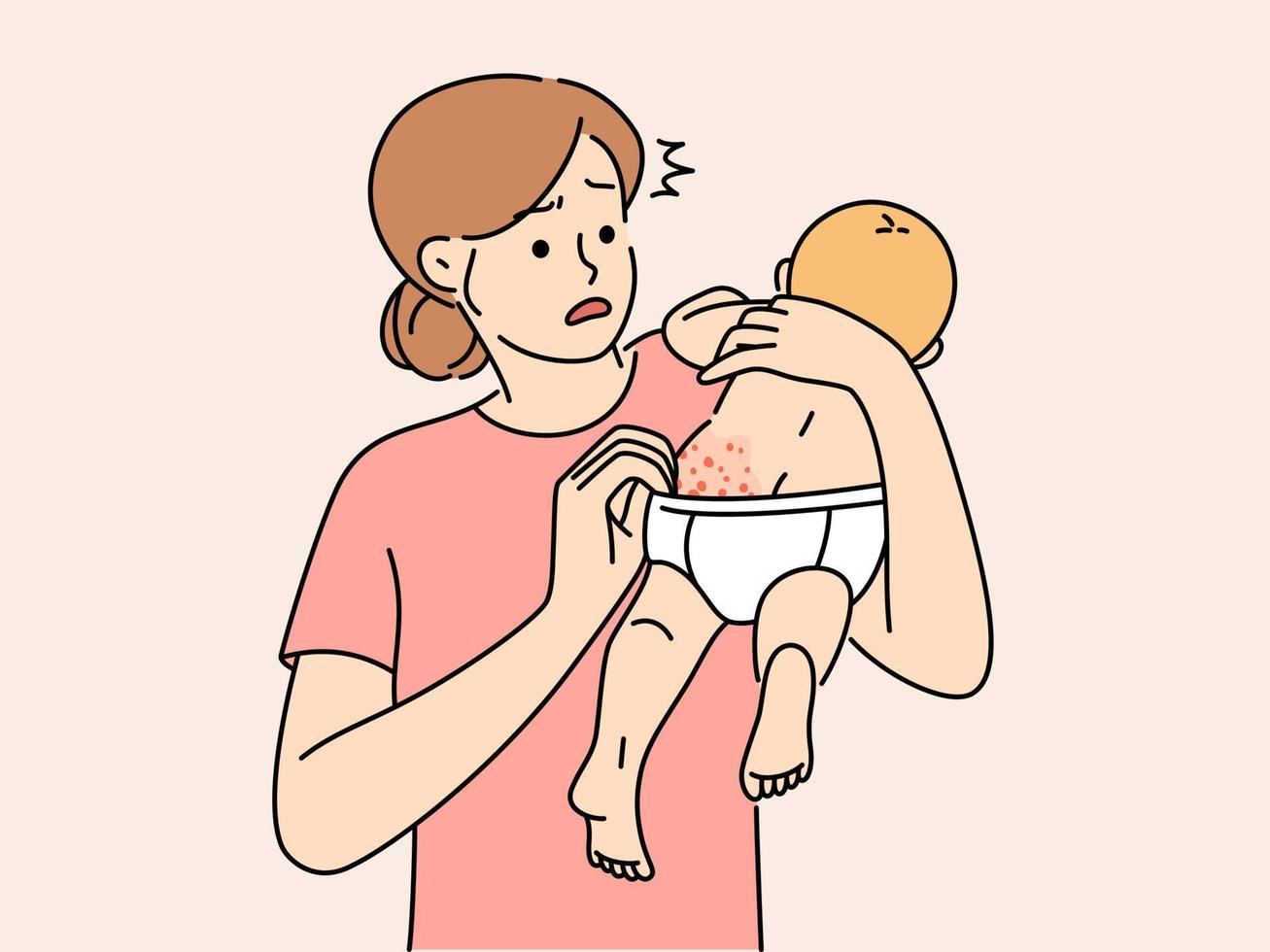 Anxious young mother confused with newborn baby body rash. Worried mom scared about child infant skin allergy. Motherhood, infantry healthcare. Vector illustration.