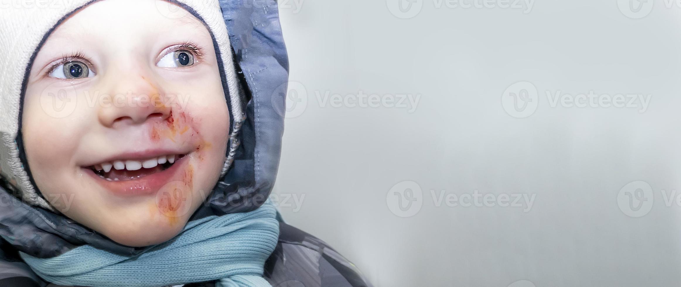 happy boy in a gray jumpsuit, a hat and a blue scarf with abrasions anointed with iodine on his face. child injury. banner with a copy space photo