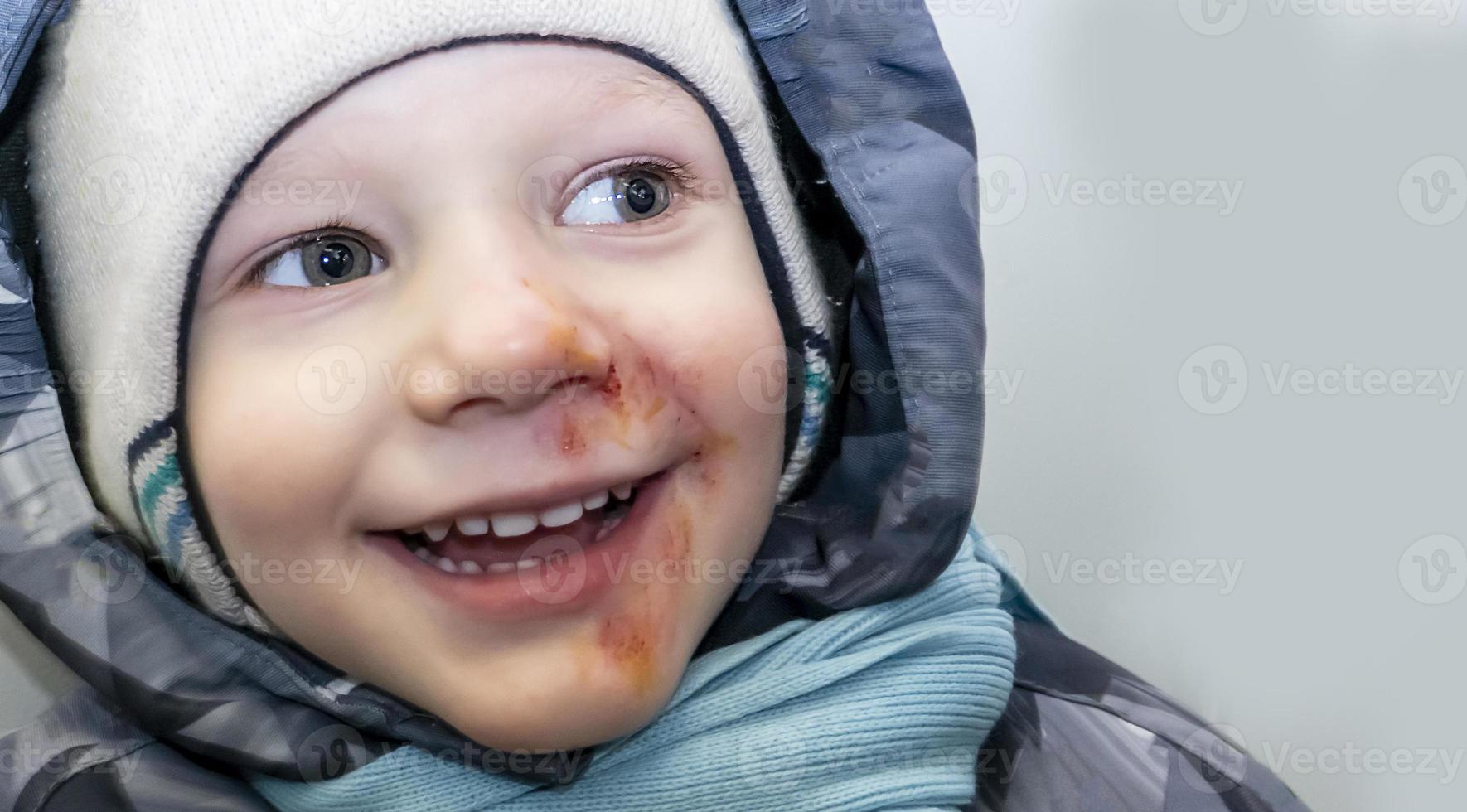 happy boy in a gray jumpsuit, a hat and a blue scarf with abrasions anointed with iodine on his face. child injury. banner with a copy space photo