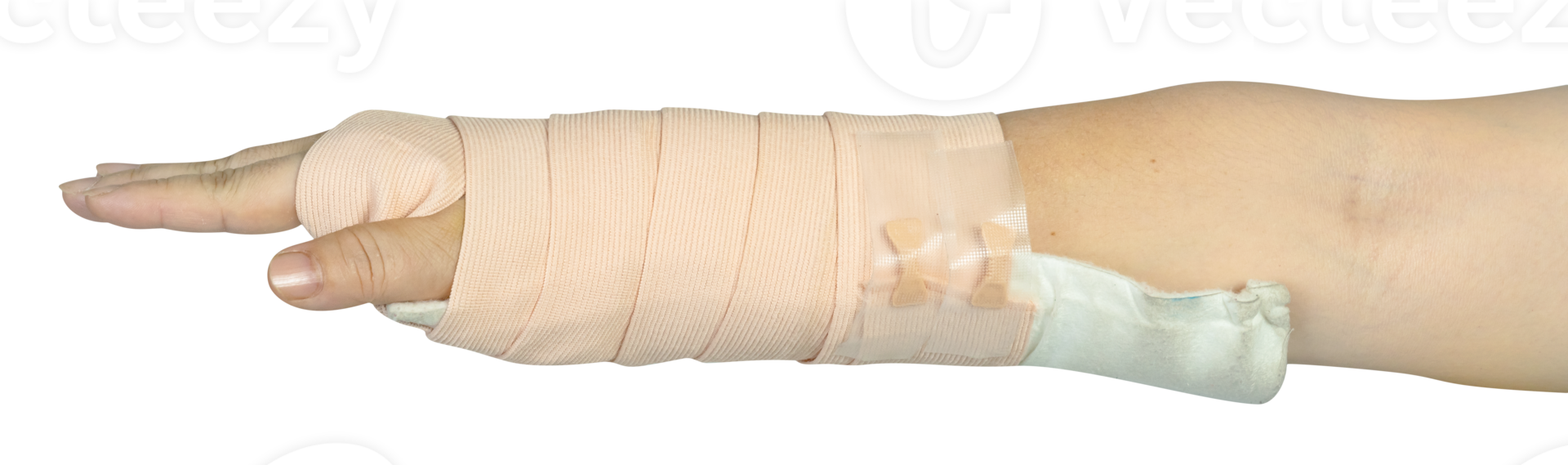 Hand making physical therapy to broken wrist from accident isolated png