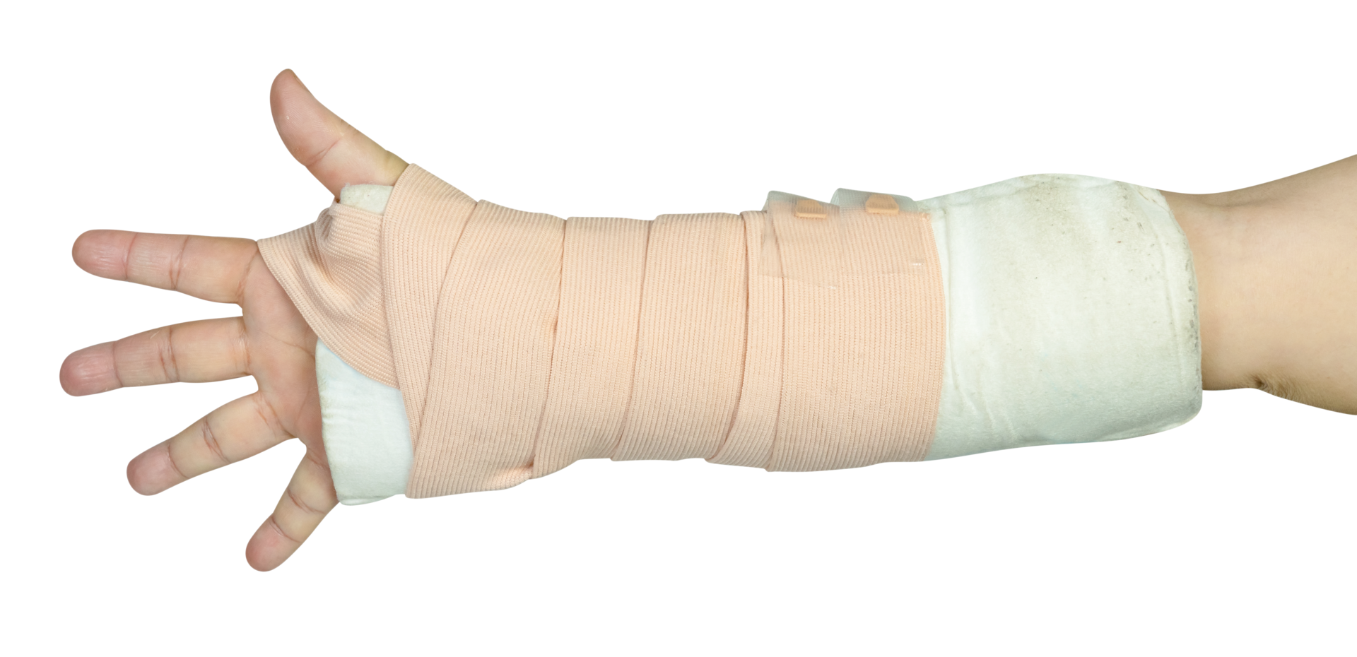 mano haciendo físico terapia a roto muñeca desde accidente aislado