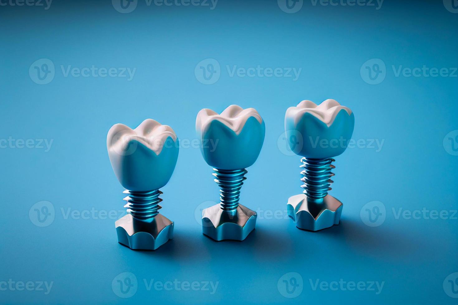 Dental implant  illustration - humant teeth medical infographic poster AI photo