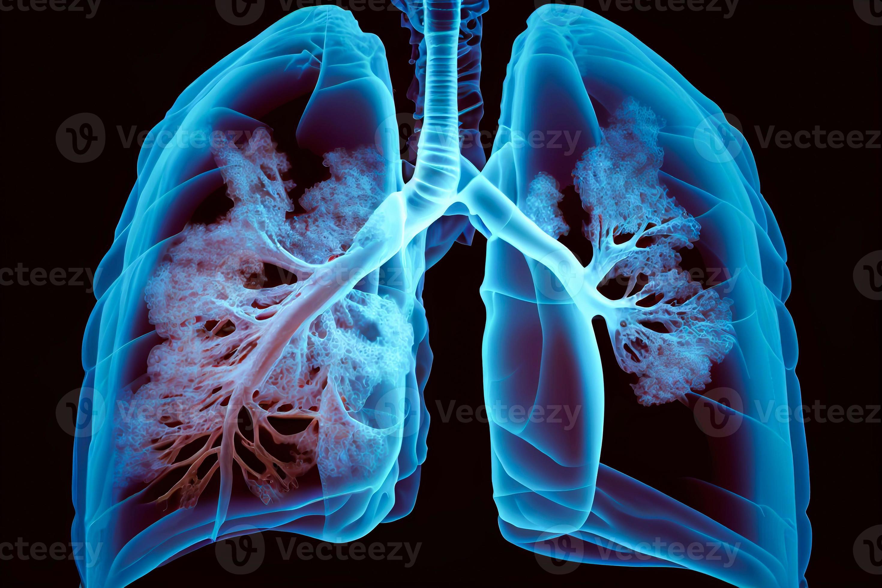 Hologram lung. Pain in the lungs from polygons, triangles, dots and