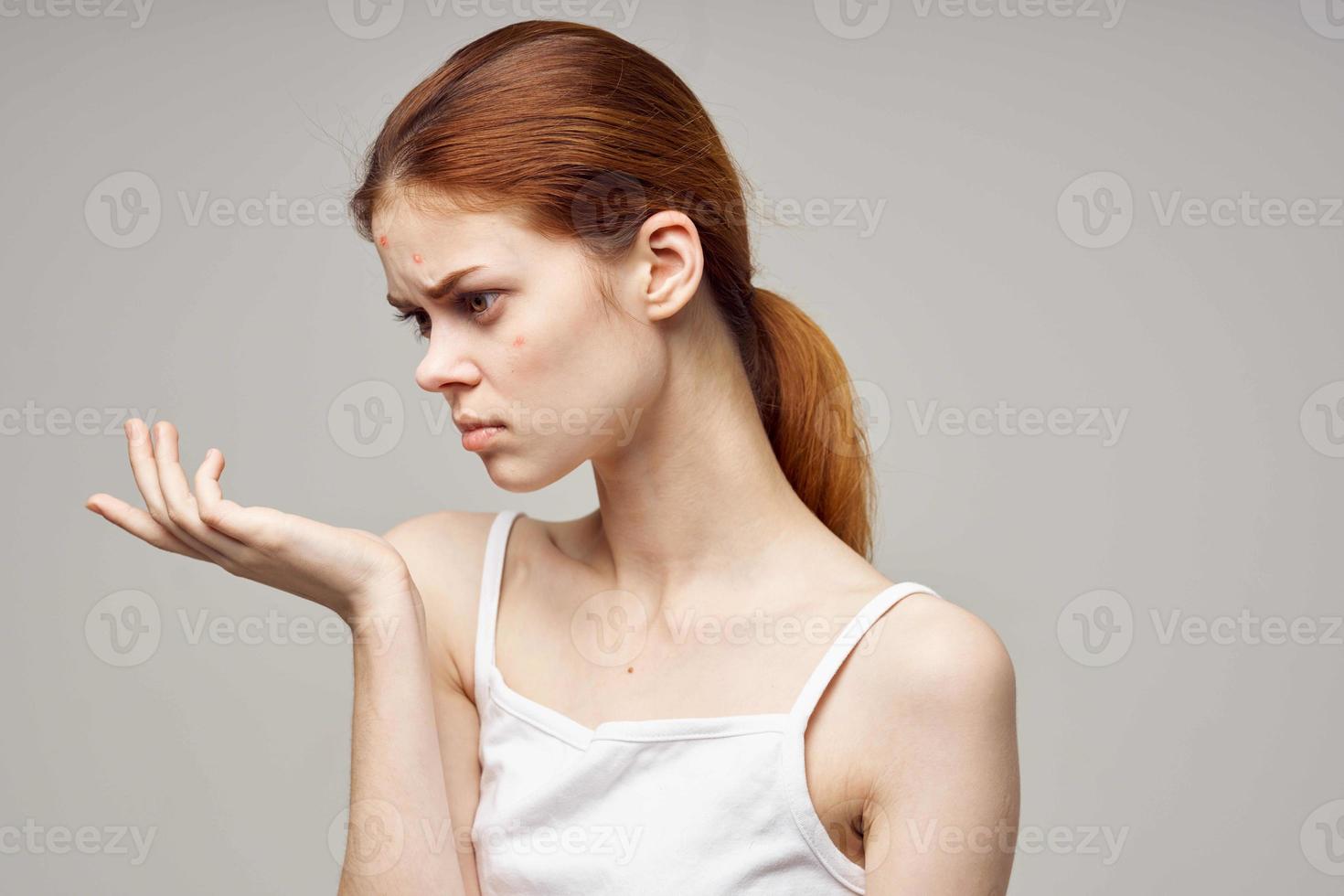 beautiful woman facial skin problems dermatology isolated background photo