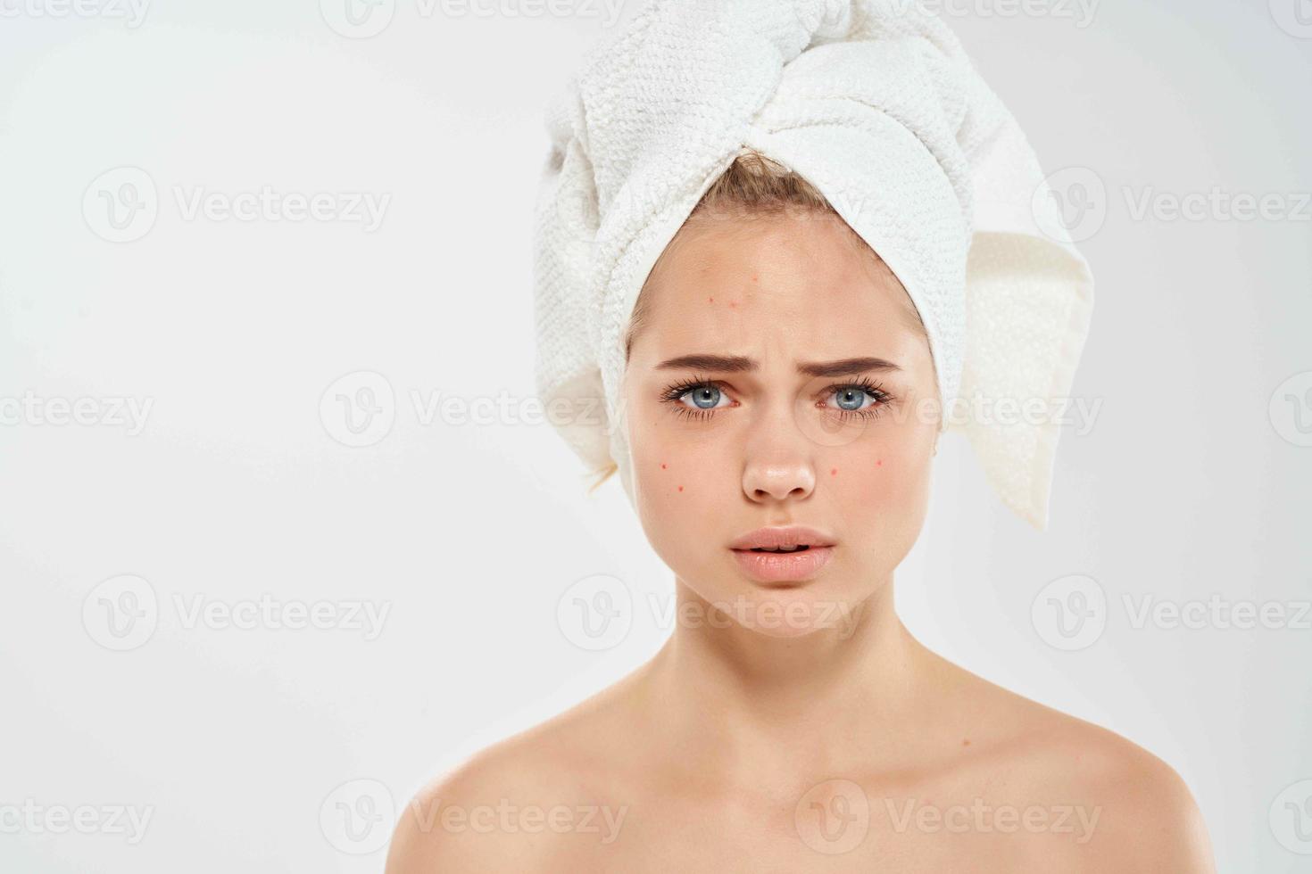 woman with towel on head face skin problems cropped view photo