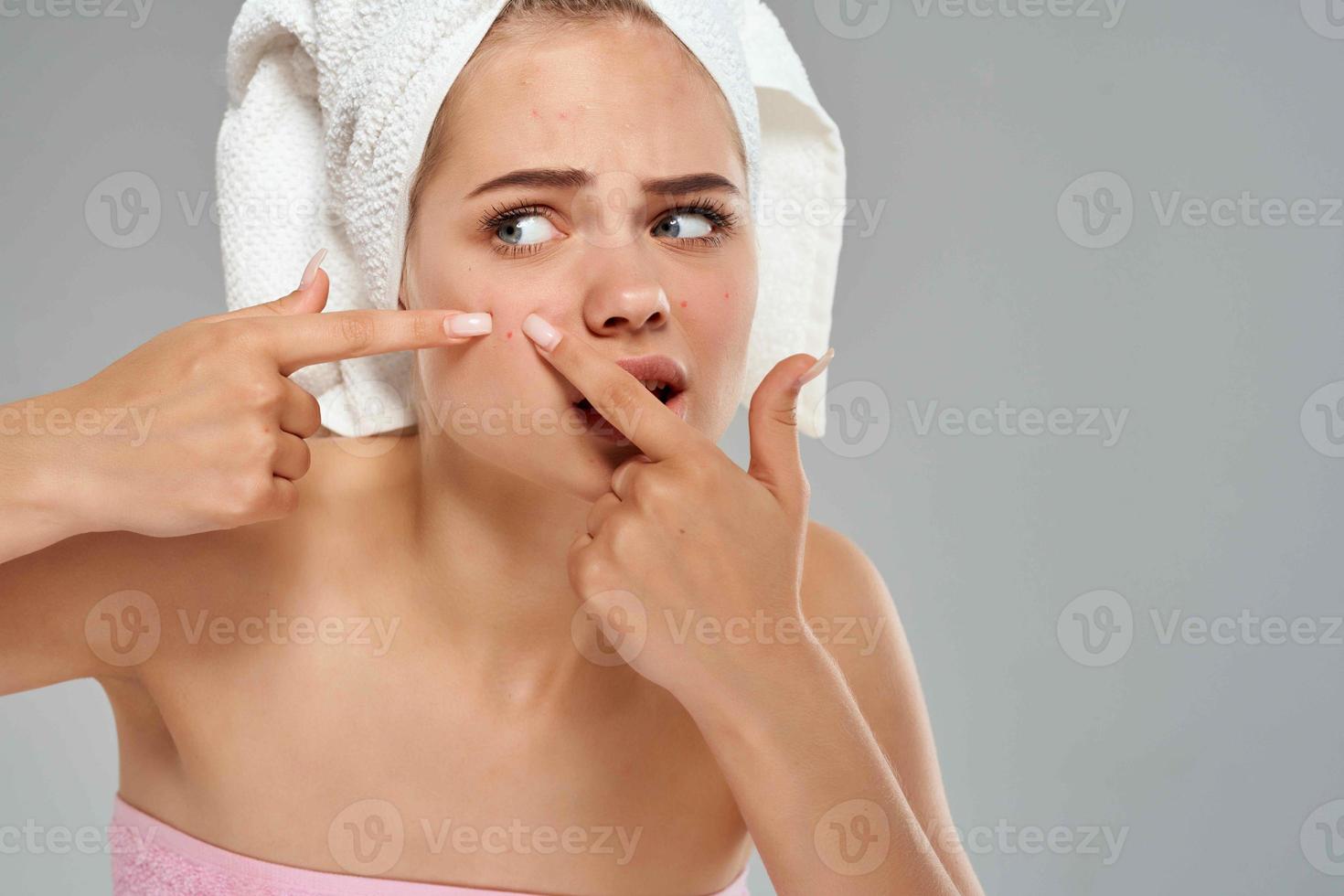 pretty woman with towel on her head squeezes out pimples on her face photo