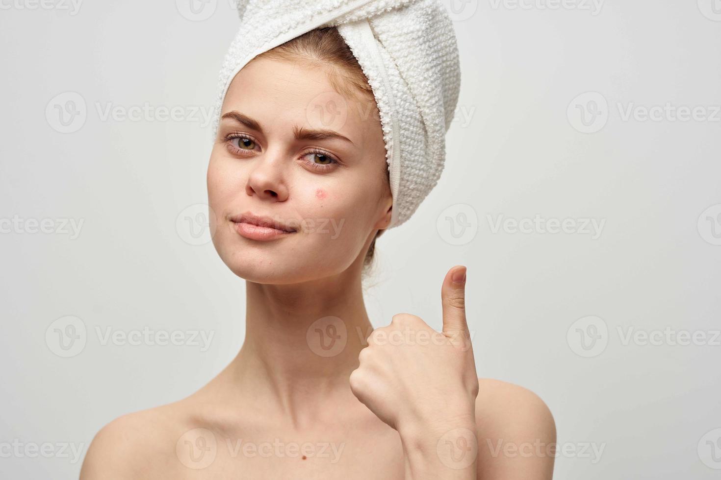 woman with a pimple on the face skin problems close-up photo