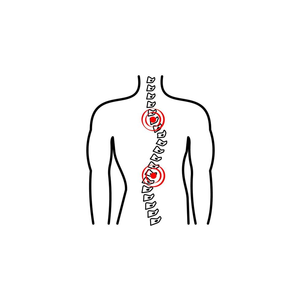 scoliosis, spine, pain vector icon